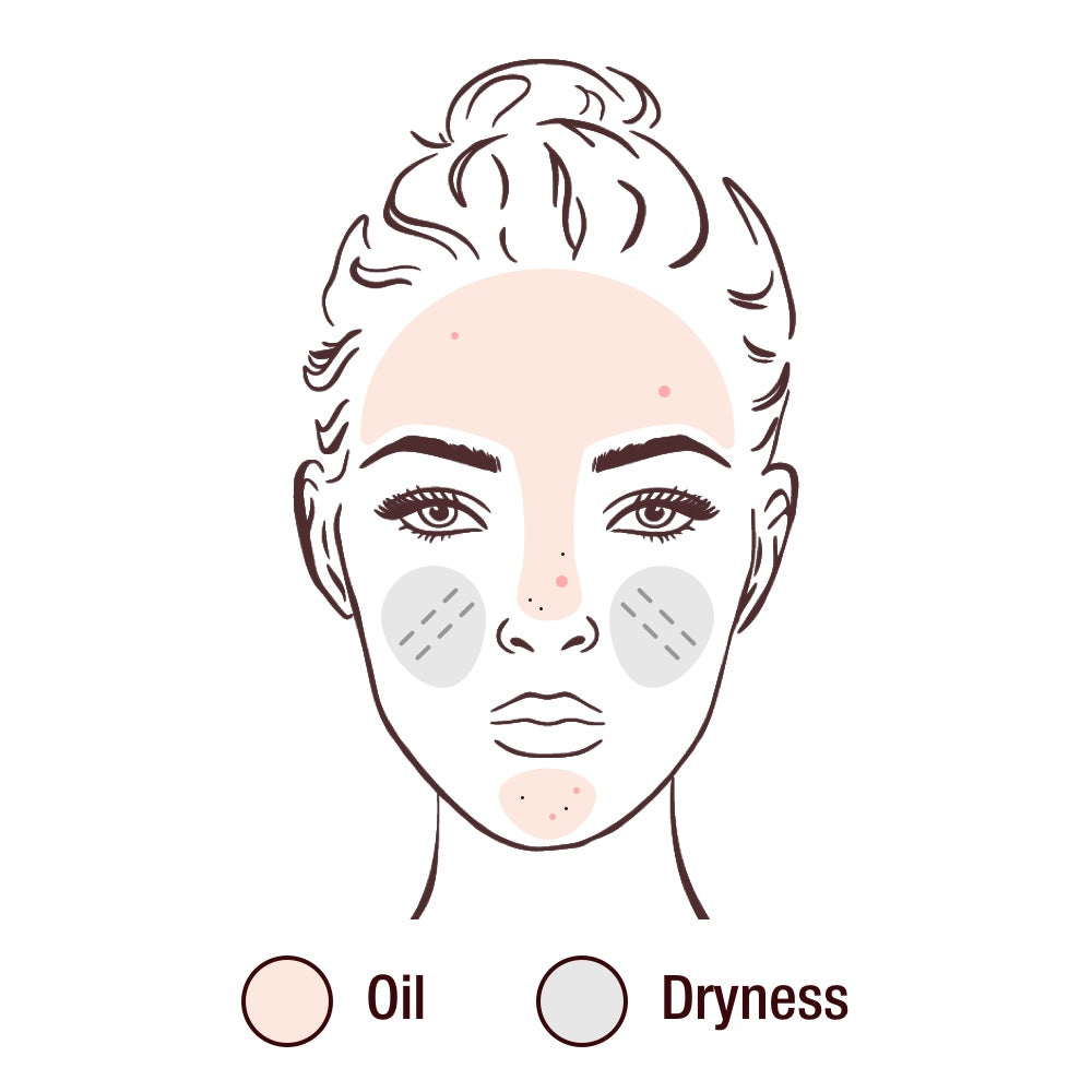 Do you know your skin type?