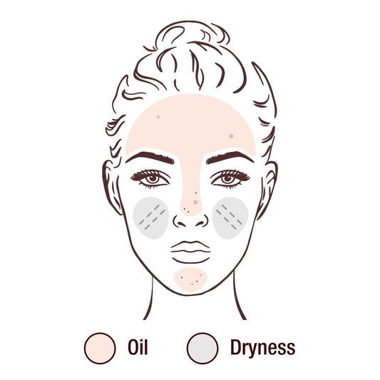 Do you know your skin type?